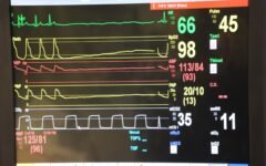 A vital-signs monitor displaying physiological waveforms such as ECG, illustrating biomedical signal analysis.