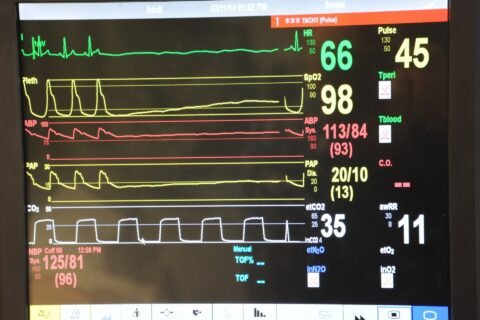 A vital-signs monitor displaying physiological waveforms such as ECG, illustrating biomedical signal analysis.