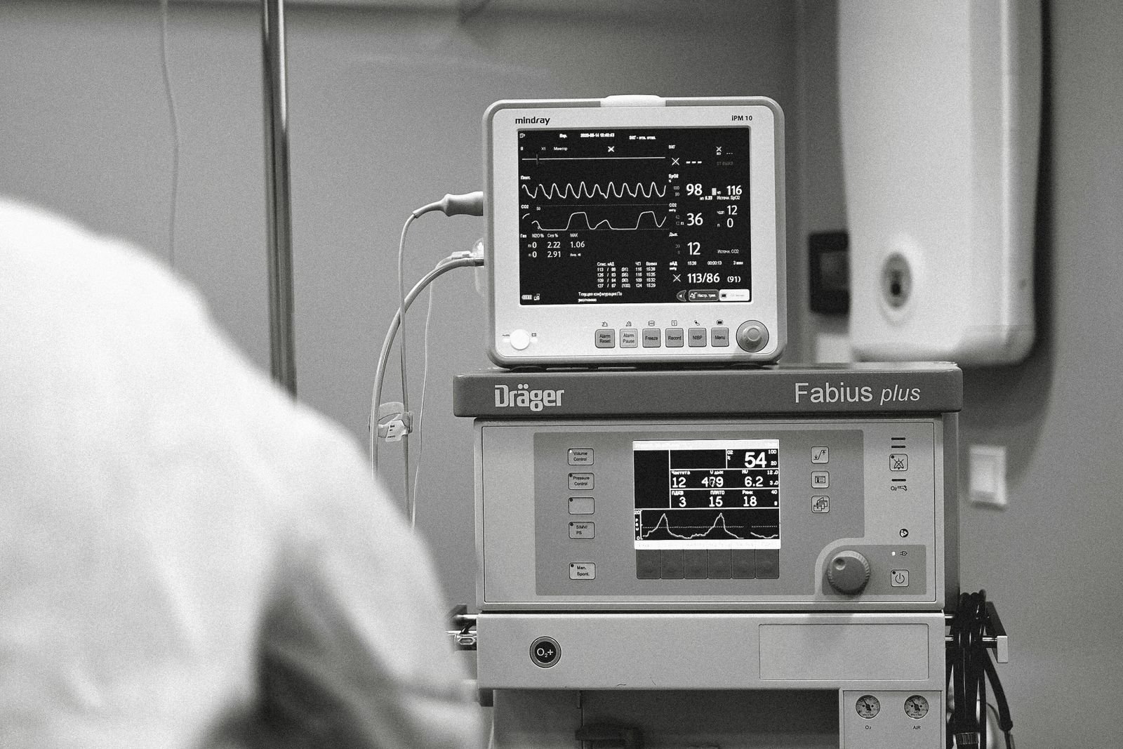 Anesthesia machine in a hospital room