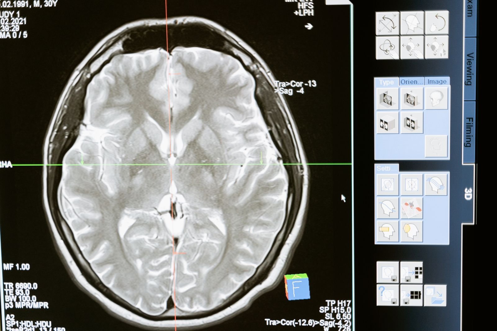 Brain MRI images on a diagnostic software workstation
